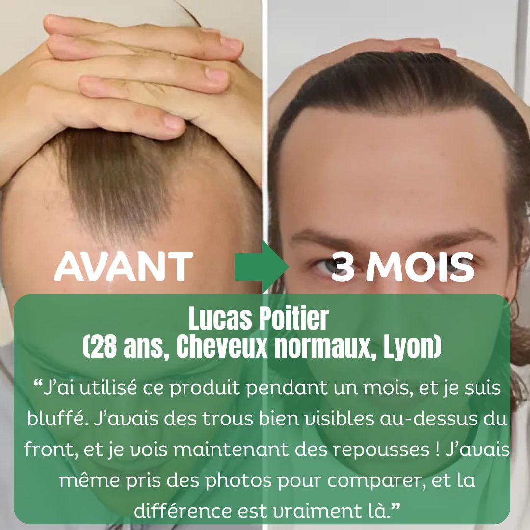 ALSANCIA - Sérum de Croissance Naturel au Romarin + Kit Bien - Être Offert