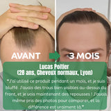 ALSANCIA - Sérum de Croissance Naturel au Romarin + Kit Bien - Être Offert