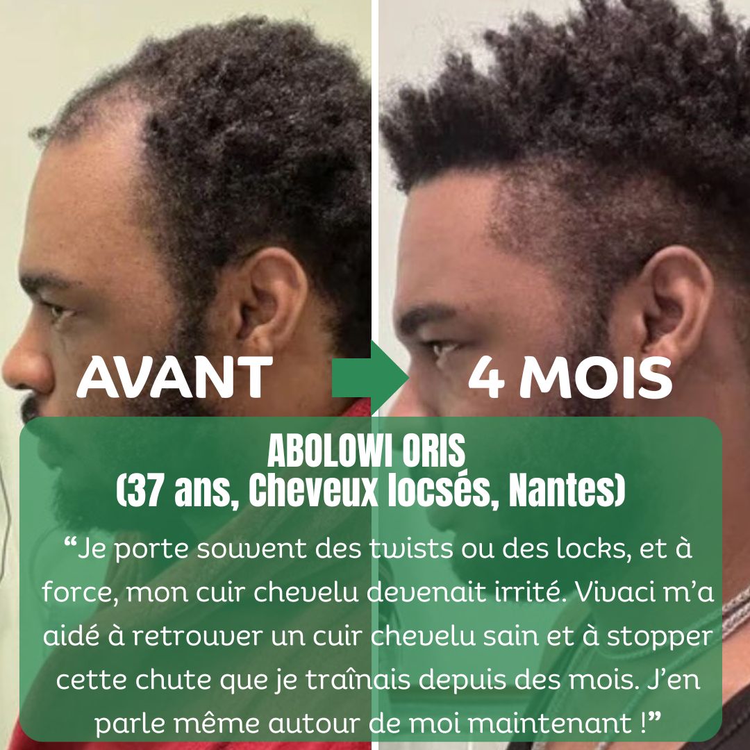 ALSANCIA - Sérum de Croissance Naturel au Romarin + Kit Bien - Être Offert