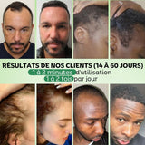 Sérum de Croissance Naturel au Romarin + Kit Bien-Être Offert