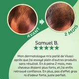 Shampoing & Après-Shampoing Fortifiants au Romarin Vivaci