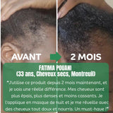 ALSANCIA - Sérum de Croissance Naturel au Romarin + Kit Bien - Être Offert